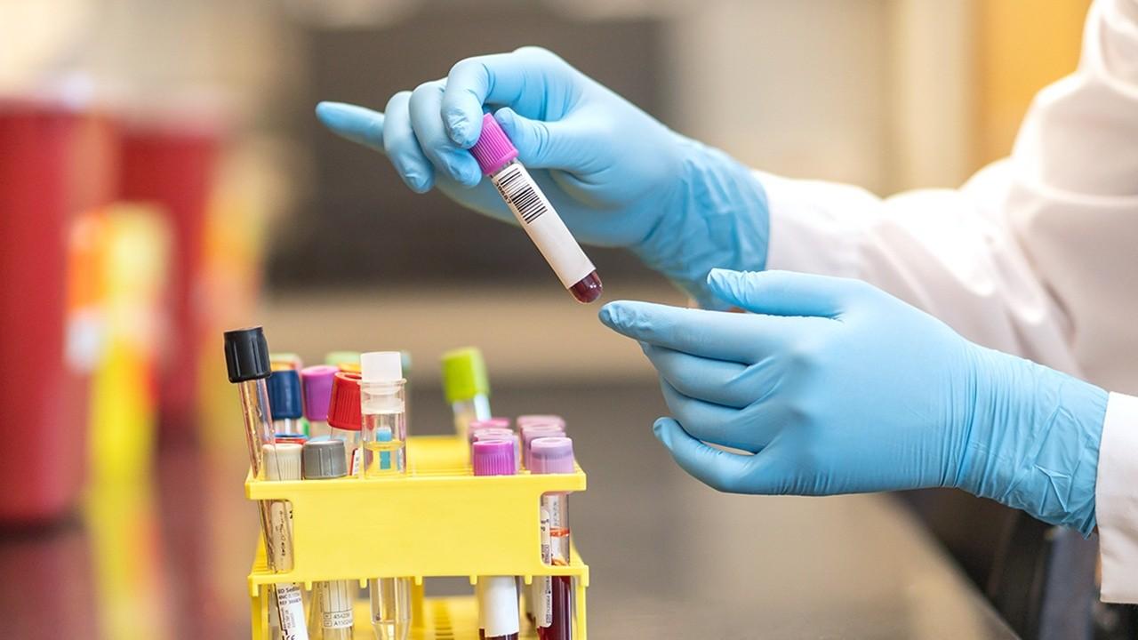 Is Donating Plasma Taxable?